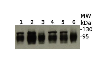 western blot detection using anti-ClpB-P antibodies